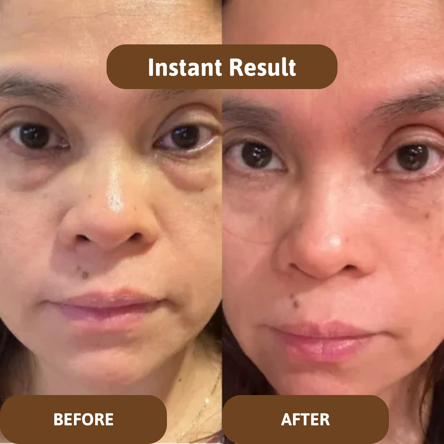 Calcium Multi-Balm